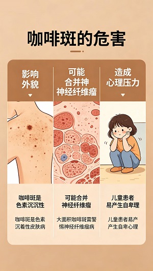 南京哪里做咖啡斑治疗？咖啡斑做激光能消除吗？